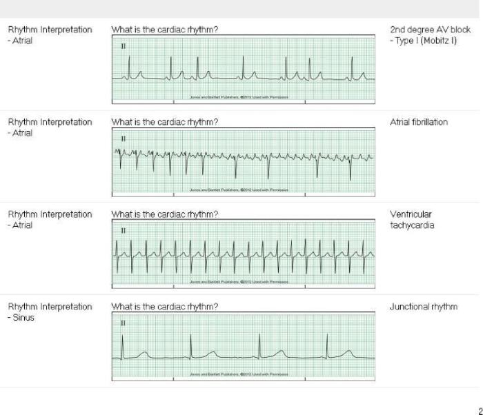 Relias dysrhythmia basic test answers